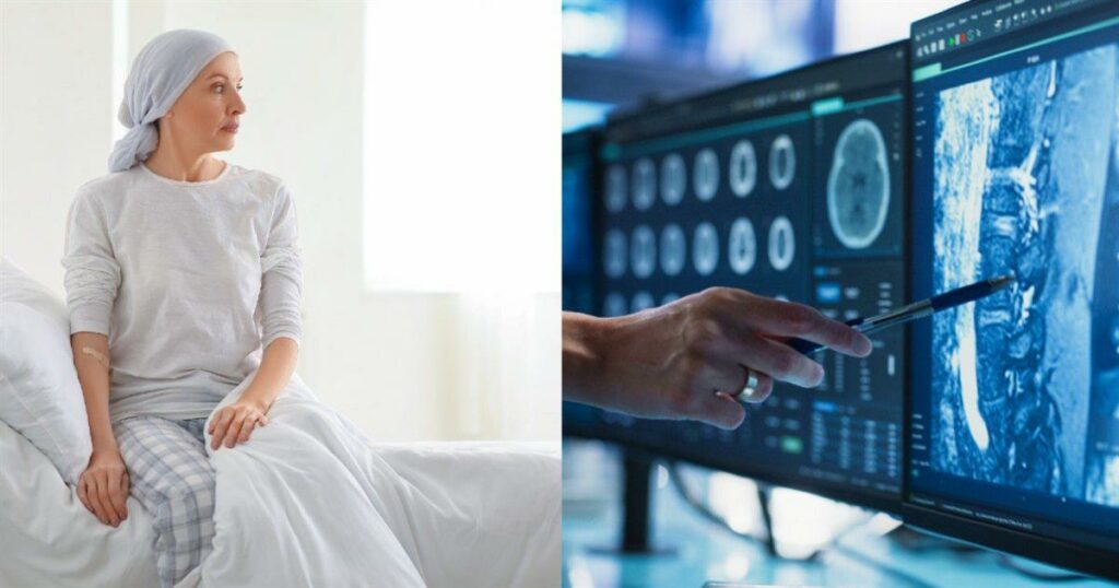 Πρόβλεψη για αύξηση 77% στα κρούσματα καρκίνου από τον ΠΟΥ – ΑΥΤΕΣ ΕΙΝΑΙ οι αιτίες