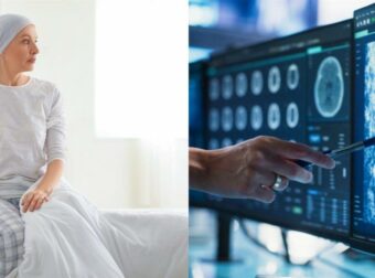 Πρόβλεψη για αύξηση 77% στα κρούσματα καρκίνου από τον ΠΟΥ – ΑΥΤΕΣ ΕΙΝΑΙ οι αιτίες