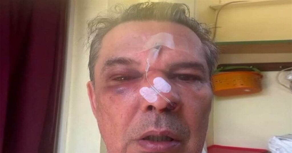 Ξυλοδαρμός σε ιατρείο – Του μαύρισε το μάτι και τον έστειλε στο νοσοκομείο για ασήμαντη αφορμή (video)