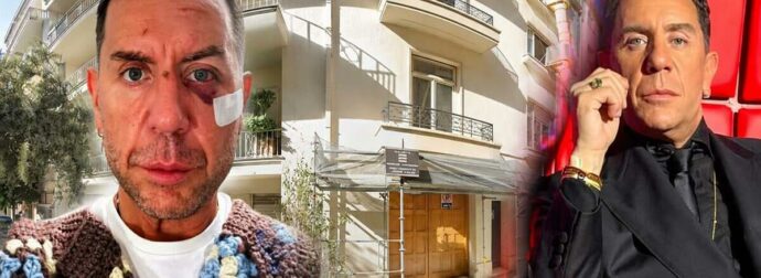 «Σβήνω σώστε με» – Τι είναι η θεραπεία πλασμαφαίρεσης που πήγε να κάνει στο Κολωνάκι ο Γιώργος Μαζωνάκης